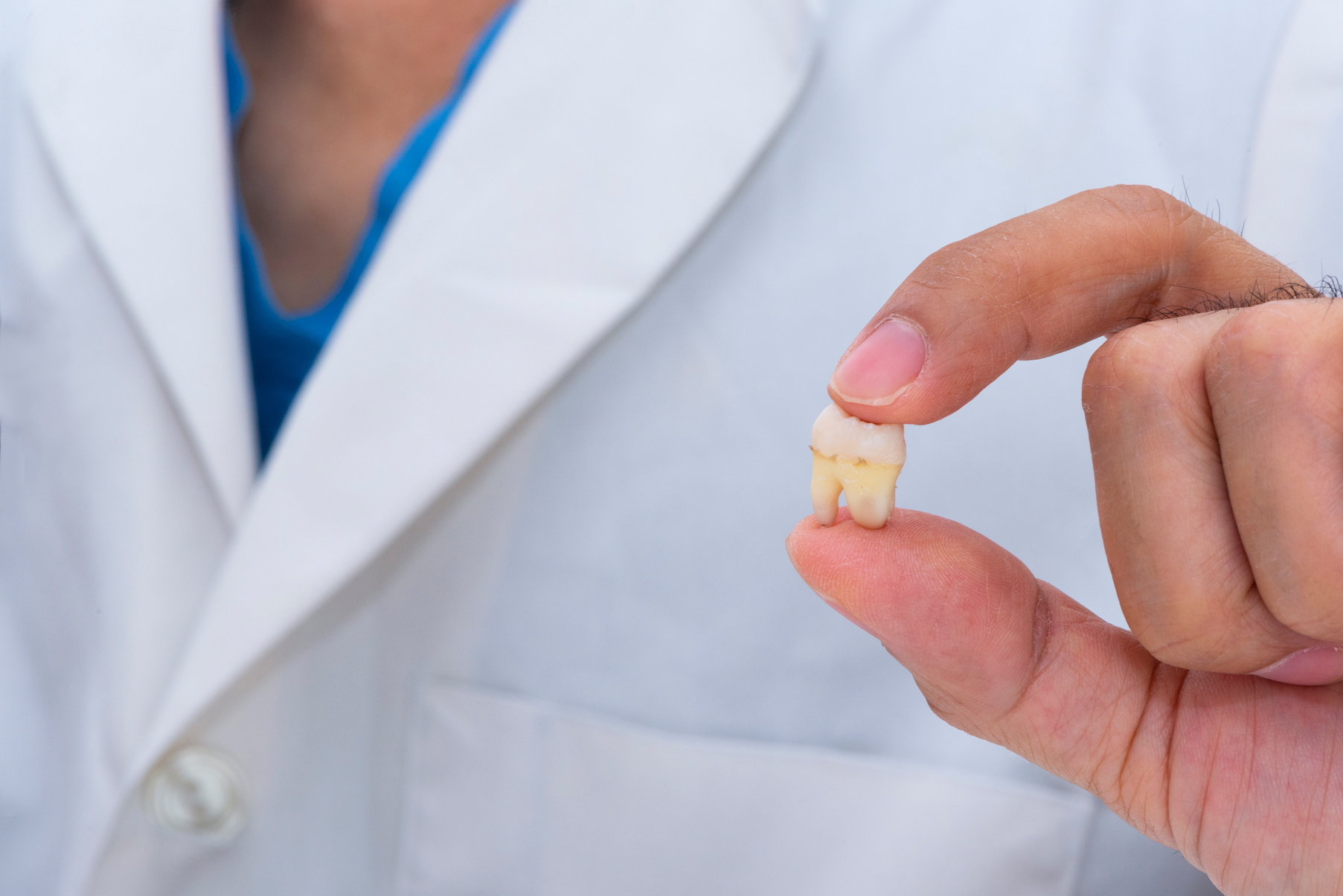 a dentist holding a tooth that has been extracted after decay resulted in needing an extraction