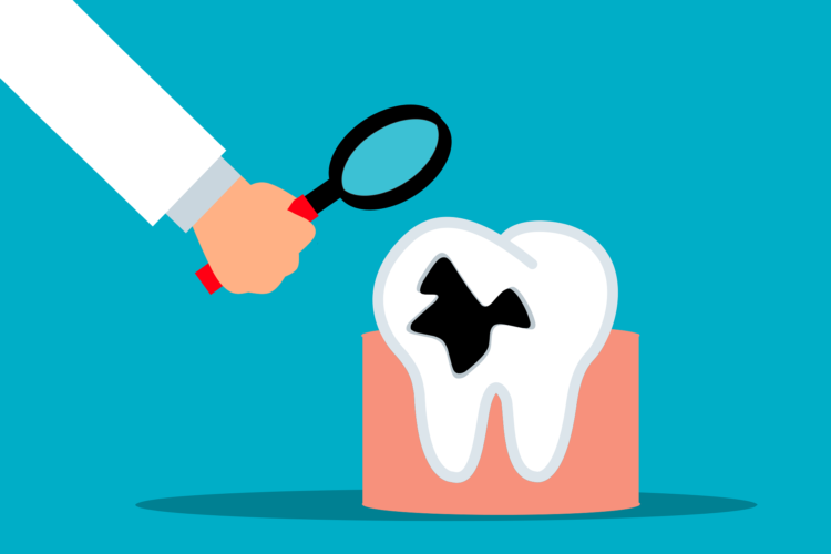 prepping for tooth extraction from tooth pain graphic